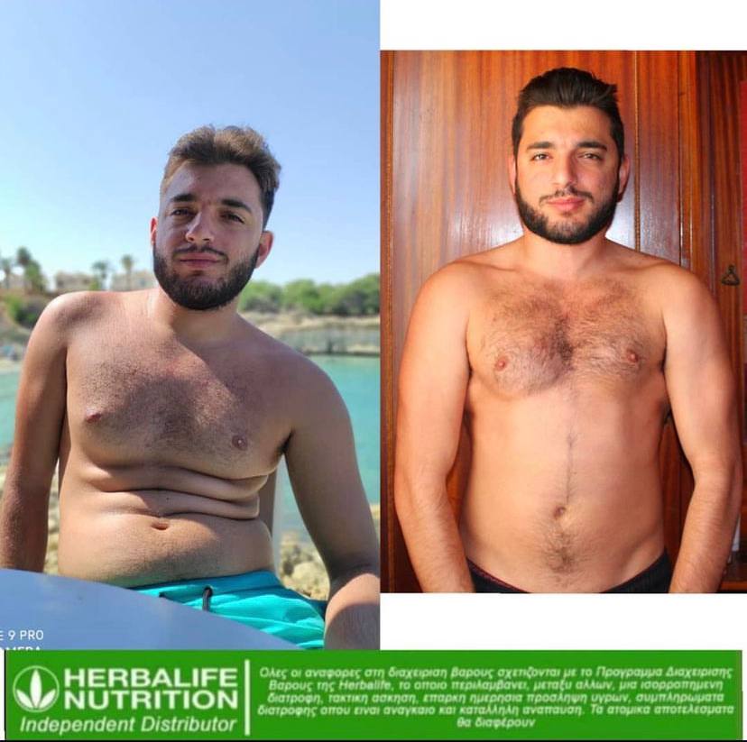 Αποτέλεσμα Απώλειας Βάρους Herbalife