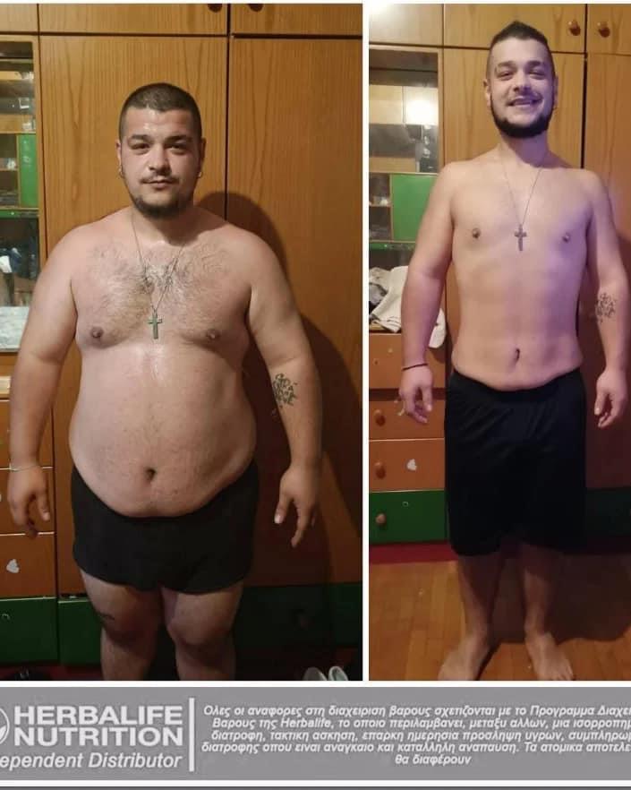 Αποτέλεσμα Απώλειας Βάρους Herbalife
